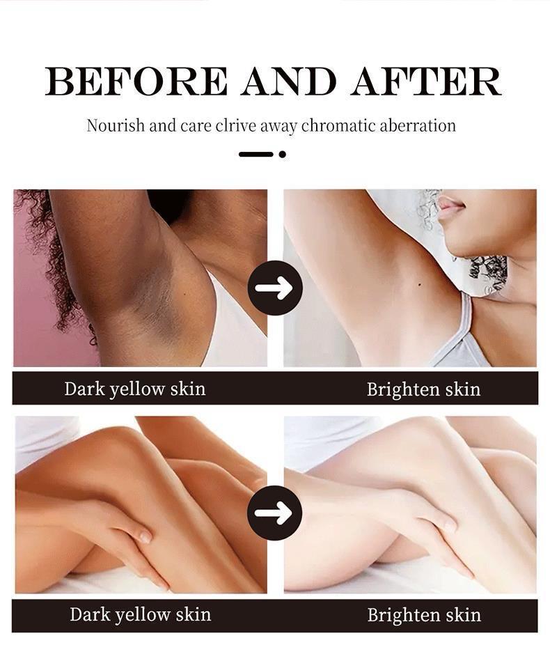 CREMA MAYCHEER ACALARADORA Y BLANQUEADOR